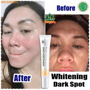 Niacinamide Skin Whitening Cream Dark Spot Cream 20g Freckle Remover Dark Spots Remover Cream Remove Melanin Pigmentation Effectively Brightening Moisturizing Face Cream Night Cream For Women