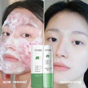 MDB Centella Asiatica Small Bubble Mask Acne Removal Blackhead Whitening Moisturizing