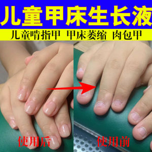Childrens Nail Growth Liquid Short Broken Nail Bed Repair Oil Layering Nutritional Deficiency Repair for Nail Care Tools