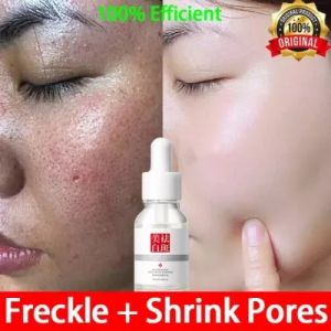 Serum Pemutih Wajah & Krim Penghilang Flek: Solusi Anti-Aging & Acne Scars