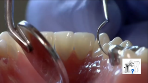 Bộ dụng cụ làm sạch cao răng cho người và thú cưng bằng thép không gỉ (mẫu mới) - Hara Pet Store