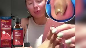 South Moon | Anti Paronychia Serum Nail Ingrown Correction Relief Pain Toenail Renewal Remove Infection Onychomycosis Nail Fungal Solution