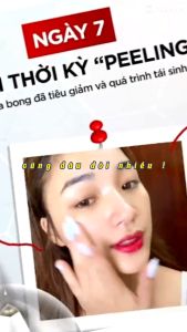 Combo Peel da vi tảo retinol MỚI 10ml serum tái tạo da sinh học peel da tại nhà Tặng Kèm Serum Le Peau B5 Phục Hồi và serum GEL THẢO MỘC