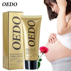 OEDO Rose Remove Stretch Mark Body Cream Nourish Moisturizing Pregnant Women Skin Remove Obesity Tattoo Care