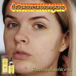 EELHOE น้ำมันหอมระเหยกลีบกุหลาบ บำรุงผิวกายเท้าป้องกันผมแตกน้ำมันหอมระเหยดูแลหลายผล