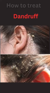 NANO HAIR GROWTH CLINIC ADE Tonic