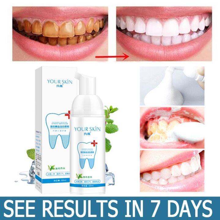 Original Teeth Whitening Mousse Toothpaste Cleansing teeth Mousse ...