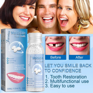 Penambal Gigi Patah, Gigi Palsu, dan Gigi Temporary: Gel Penambal Gigi Temporary