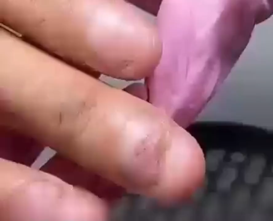 Antibacterial Inhibit Bacteria Nail Stickers/Nail Fungus Treatment/Quick Fix Nail Care Patch