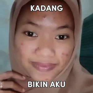 Paket Hemat Orlin Beauty Day and Night Cream 10gr Mencerahkan Wajah Kulit Sensitif Bekas Jerawat Flek Hitam Skincare BPOM