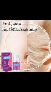 kem trị sẹo rỗ mặtkem mờ sẹo60g