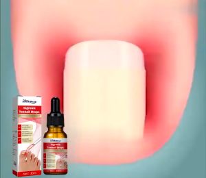 South Moon Ingrown Toenail Drops 30ml Nail Fungus Treatment Onychomycosis Repair Care Essential Oil
