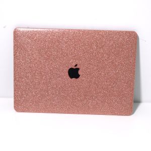SisterHome Macbook Glitter Bling Shine Bling Hard Case for Macbook Air Pro case 13 14 15 16 inch M4 M3 M2 M1 A3112 A3401 A3113 A2681 A3114 A2991 A2941 A2338 A2251 A3403 A2337 A2918 A2179 A1466 A2992