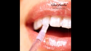 GlorySmile PearlShine Whitening Gloss Stick - Instant Teeth Brightening with Pearl Finish - 45ml