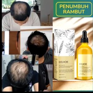 Minyak Rosemary Anti Rontok & Penumbuh Rambut Botak