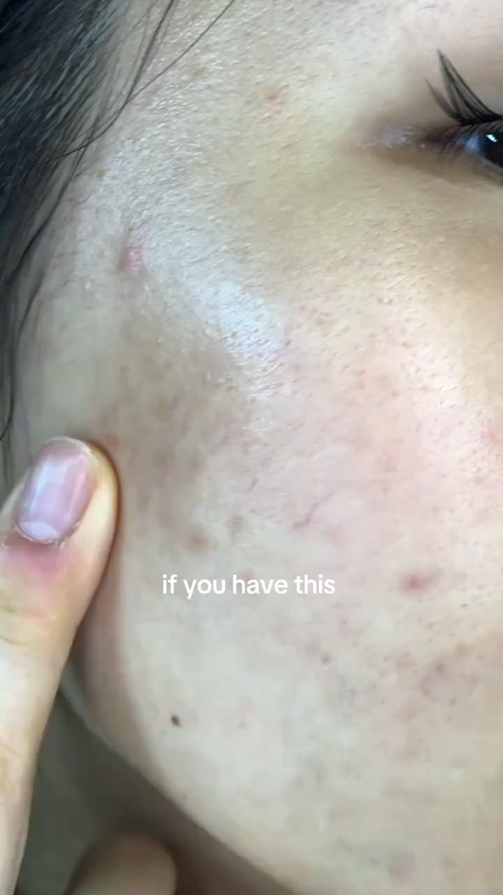 Jumiso Niacinamide 20% Brightening Serum 40ml – Dark Spot Corrector with TXA & Glutathione