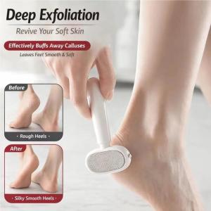 Cammuo Double Sided Foot Scraper and File Safe Callus Remover Tool for Dead Skin Heels Detachable Washable Pedicure Kit for Men Women