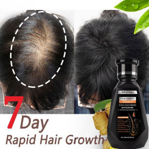 Anti Hair Loss Shampoo Hair Growth Shampoo For All Types Of Hair 250ML