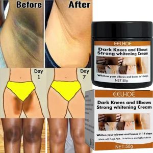EELHOE | Body Whitening Cream Private Parts Underarm Bleaching Serum Whiten Butt Knee Brighten Inner Thigh Intimate Dark Remove Melanin