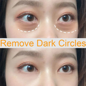 SADOER Eye Cream Anti Aging menghilangkan milia menghilangkan keriput di mata dan kantung mata memudarkan lingkaran hitam di mata 20g