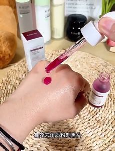 👑果酸水杨酸精华液acne serum treatment ubat jerawat fruit acid acne spot treatment hilangkan jerawat Shrinking Pores Acne Treat