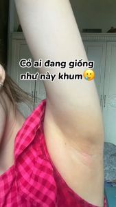 Kem Thâm Nách Alpha Arbutin 3 Plus Precious Skin Thái Lan (50g) Giảm Thâm Trắng Da Vùng Nách Đầu Gối Khủy Tay Bikini