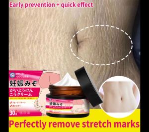 Anti Stretch Mark Cream Stretch Mark Remover Cream Scars Remover Cream Improvement and Elimination of Stretch Mark Appearances Stretch Marks Whitening Fades Stretch Marks