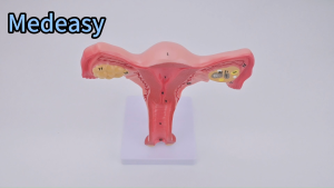 Female Uterine Anatomy Teaching Model Uterus Anatomical Model
