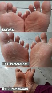 Lanbena foot peel mask/ masker kaki original 100%