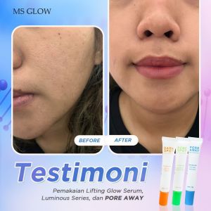 Pore away Ms glow /Drak spot tretment Ms glow/Acne spot Ms glow original
