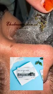 Feel Off Mask Premium Ehabeautyskin Masker Ampuh Angkat Komedo Sampe Akar-Akarnya Bpom Original Asli