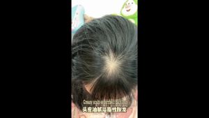 Anti Hair Loss Solution Hair Growth Serum 60ml Silicone-Free | Anti Hair Loss /Hair Fall | Improve |Hair Growth | Hair treatment 防脱发育发液