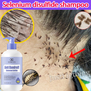 Anti Dandruff Shampoo Lice Shampoo Shampoo Kelemumur Mite Removal Anti Dandruff Oil Control Deep cleansing of the scalp 二硫化硒洗发水300ML