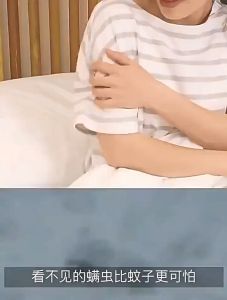 สเปรย์กำจัดไรฝุ่น, กำจัดไรฝุ่น และ บนที่นอน หมอน ผ้าห่ม ลดอาการภูมิแพ้ ไอจามคันจากไรฝู่นส์ กําจัดไรฝู่น - บริการสเปรย์ฆ่าไรฝู่นส์สำหรับการลดอาการภูมิแพ้ด้วยเบื้องต้น ไม่ใช่เครื่องสำอาง