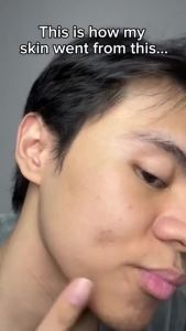 Itskin Glutathione Collagen Glow Gummies for Men Original Anti-Aging Glutathione Collagen For Men