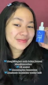 EMINA Ms. Pimple Acne Solution Face Serum 30ml