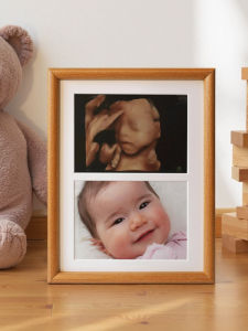 Bộ Khung Ảnh 4 Tấm 8 Inch Phong Cách Hiện Đại Đơn Giản Của May Hua Gallery Cho Ảnh Siêu Âm 4 Chiều Cho Bé Và Cặp Đôi