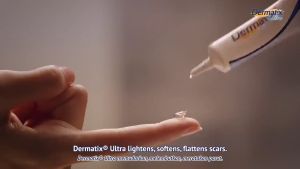 Dermatix Ultra Advanced Scar Formula Acne Scar Removal Cream Skin Repair Scars Burns Cuts Pregnancy Stretch Marks Faralex Scar Remover Acne Spots Acne Treatment Blackhead Whitening Cream Stretch Marks for Face and Body Effective tanggal peklat pekas