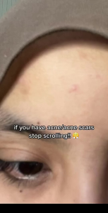 SKINTIFIC Mugwort Clay Mask Stick Mask Cleansing Clay Masker Muka Travel Friendly (40g)