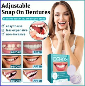 Cost-effective Denture Economics No Hospitals Orthodontic Brace Spotlessly White Finish Filling Your Teeth 可调节卡扣式假牙