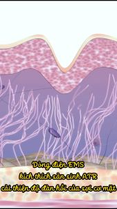 Máy đẩy tinh chất xung điện EMS và massage làm mờ nếp nhăn mặt cổ