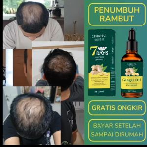[BPOM APPROVE] CINDYNAL Ginger Germinal Oil  Hair Care Growth Serum Obat Penumbuh Rambut Botak Rontok 30ml Minyak Pertumbuhan Rambut Cindynal Perawatan Rambut Ginseng - Lazada
