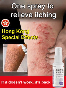 ✨HOT✨【Eczema Killer】Skin Care Liquid Dressing/Relieves Itchy Skin Gentle and Non-irritating Eczema Spray/Herbal Skin Cream Liquid Dressing皮肤护理液体敷料