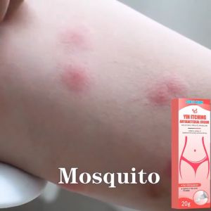 Skin Singworm Ointment / Private Itching Relieving Cream /ubat gatal gatal kulit /20g Personal Care/ Inner Thigh Skin Eczema/ Deodorization/Root Removal/And Vaginitis Cream
