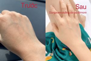 Bơ Gấc Dưỡng Ẩm Và Ngăn Ngừa Lão Hóa Da Tay Da Chân Bimore 50ml