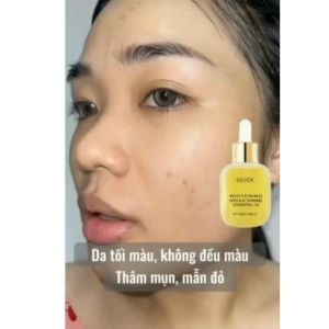[HÀNG XỊN]Serum Vitamin C Siêu Dưỡng Trắng Hết Nhăn Giảm Mụn Trẻ Hóa Da Giúp Da Đều Màu- Giúp Da Bạn Trắng Dần Lên Sau Mỗi Lần Sử Dụng Se Khít Lỗ Chân Lông Làm Mờ Các Dấu Hiệu Lão Hóa Da Tăng Cường Bảo Vệ Da Chống Tia UV