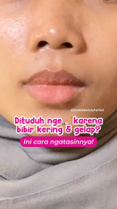 LIP GLOW MAGIC SR12 / LIP GLOSS SERUM BIBIR SR12 HERBAL SKINCARE / LIPSTIK & PELEMBAB BIBIR ALAMI /SERUM BIBIR