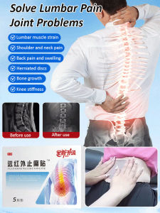 Lumbar Vertebrae Care Pain Relief Acupuncture Patch Lumbar Disc Herniation Lumbar Muscle Strain