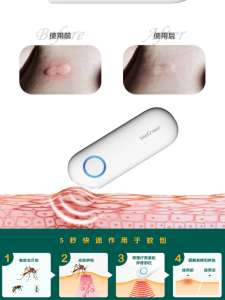 Máy Giảm Ngứa Côn Trùng Cầm Tay Di Động Liệt Trị Liệu Vật Lý Hồng Ngoại Máy Giảm Ngứa Tại Nhà Và Ngoài Trời Cho Bà Bầu Và Trẻ Em