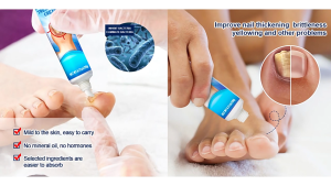 💅🏻เซรั่มบำรุงเล็บ เห็นผลภายใน7วัน เอสเซ้นส์ดูแลเล็บ nail repair serum ดูแลเล็บรักษาโรคเชื้อราที่เล็บเล็บเปราะ